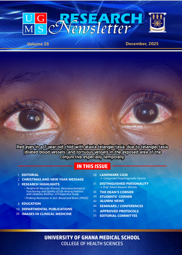 Research Newsletter | University of Ghana Medical School